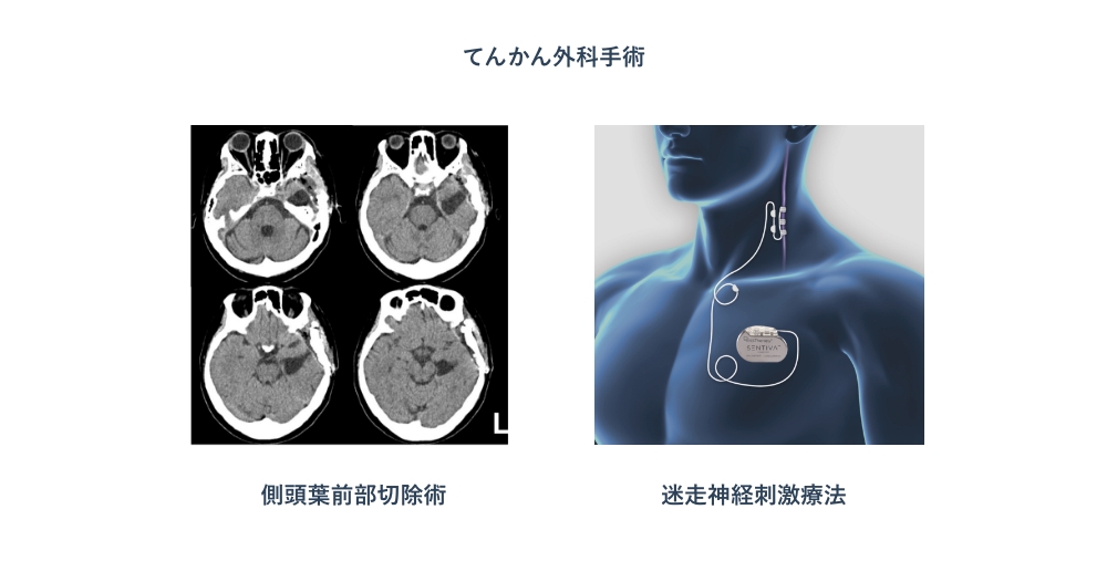 迷走神経運動のやり方